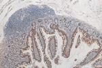 GPBP1 Antibody in Immunohistochemistry (Paraffin) (IHC (P))