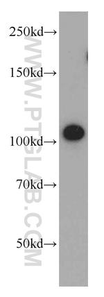 STRN Antibody in Western Blot (WB)