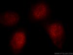 RNF20 Antibody in Immunocytochemistry (ICC/IF)