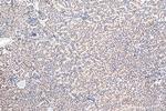 RNF20 Antibody in Immunohistochemistry (Paraffin) (IHC (P))