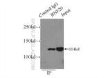 RNF20 Antibody in Immunoprecipitation (IP)