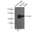 RNF20 Antibody in Immunoprecipitation (IP)