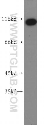 RNF20 Antibody in Western Blot (WB)