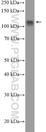 RNF20 Antibody in Western Blot (WB)