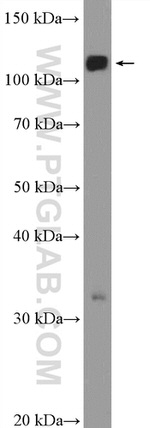 RNF20 Antibody in Western Blot (WB)