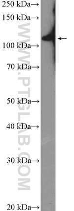 RNF20 Antibody in Western Blot (WB)