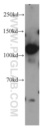 KIF5B Antibody in Western Blot (WB)