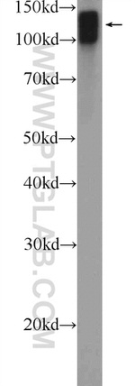 KIF5B Antibody in Western Blot (WB)