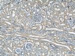 KIF5B Antibody in Immunohistochemistry (Paraffin) (IHC (P))