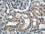 KIF5B Antibody in Immunohistochemistry (Paraffin) (IHC (P))