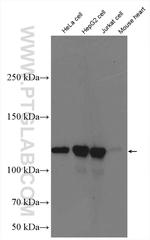 KIF5B Antibody in Western Blot (WB)