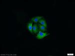 MAP1B Antibody in Immunocytochemistry (ICC/IF)