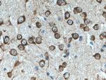 MAP1B Antibody in Immunohistochemistry (Paraffin) (IHC (P))