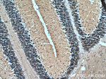 MAP1B Antibody in Immunohistochemistry (Paraffin) (IHC (P))