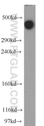 MAP1B Antibody in Western Blot (WB)