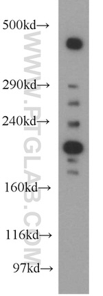 MAP1B Antibody in Western Blot (WB)