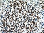 SMARCA4/BRG1 Antibody in Immunohistochemistry (Paraffin) (IHC (P))