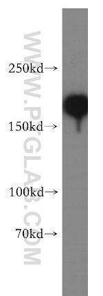 SMARCA4/BRG1 Antibody in Western Blot (WB)