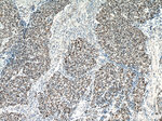 SMARCA4/BRG1 Antibody in Immunohistochemistry (Paraffin) (IHC (P))