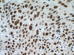 SMARCA4/BRG1 Antibody in Immunohistochemistry (Paraffin) (IHC (P))