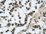 SMARCA4/BRG1 Antibody in Immunohistochemistry (Paraffin) (IHC (P))