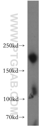 SMARCA4/BRG1 Antibody in Western Blot (WB)