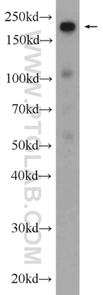 SMARCA4/BRG1 Antibody in Western Blot (WB)