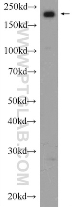 SMARCA4/BRG1 Antibody in Western Blot (WB)