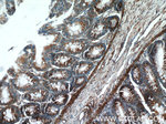 RPLP1 Antibody in Immunohistochemistry (Paraffin) (IHC (P))