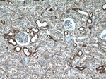 RPLP1 Antibody in Immunohistochemistry (Paraffin) (IHC (P))