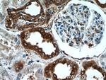 RPLP1 Antibody in Immunohistochemistry (Paraffin) (IHC (P))