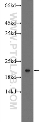 RPLP1 Antibody in Western Blot (WB)