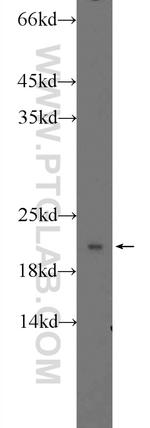 RPLP1 Antibody in Western Blot (WB)