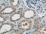 AKT3 Antibody in Immunohistochemistry (Paraffin) (IHC (P))