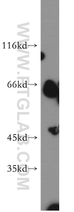 AKT3 Antibody in Western Blot (WB)