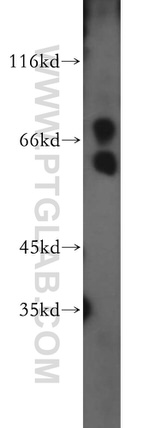 AKT3 Antibody in Western Blot (WB)