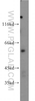 AKT3 Antibody in Western Blot (WB)