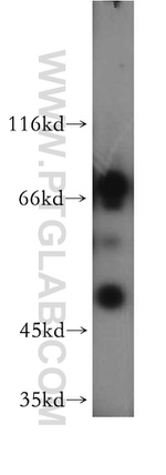 AKT3 Antibody in Western Blot (WB)