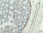 MYLK Antibody in Immunohistochemistry (Paraffin) (IHC (P))