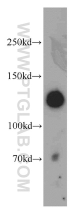 MYLK Antibody in Western Blot (WB)