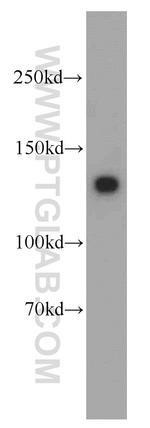 MYLK Antibody in Western Blot (WB)