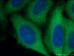 ROCK2(middle) Antibody in Immunocytochemistry (ICC/IF)