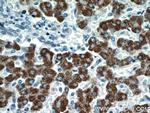 ROCK2(middle) Antibody in Immunohistochemistry (Paraffin) (IHC (P))