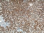 ROCK2(middle) Antibody in Immunohistochemistry (Paraffin) (IHC (P))