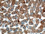 ROCK2(middle) Antibody in Immunohistochemistry (Paraffin) (IHC (P))