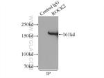 ROCK2(middle) Antibody in Immunoprecipitation (IP)