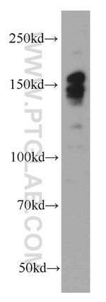 ROCK2(middle) Antibody in Western Blot (WB)