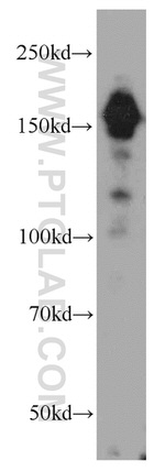 ROCK2(middle) Antibody in Western Blot (WB)