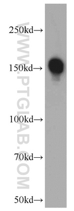 ROCK2(middle) Antibody in Western Blot (WB)