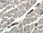 PRKG1 Antibody in Immunohistochemistry (Paraffin) (IHC (P))